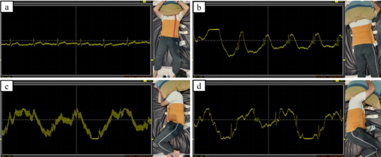 Contoh tampilan hasil pengolahan sinyal yang dikirimkan matras SleepCare dari berbagai posisi tidur pengguna