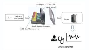 Metodologi-sistem-ECG-12-Lead-secara-keseluruhan-1024x575 ITS Computer Engineering