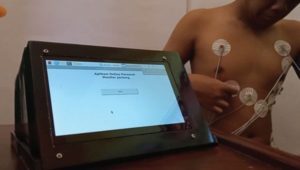 Penggunaan-ECG-12-Lead-pada-pasien-jantung ITS Computer Engineering