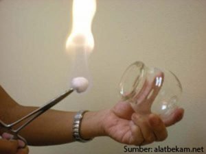 Lewat Bekam, JMMI Kenalkan Kesehatan Ala Nabi