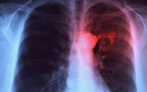 TB Analyzer Karya ITS Percepat Diagnosis Tuberkulosis