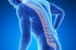 Osteoporosis: Penyakit Segala Usia, Jangan Disepelekan
