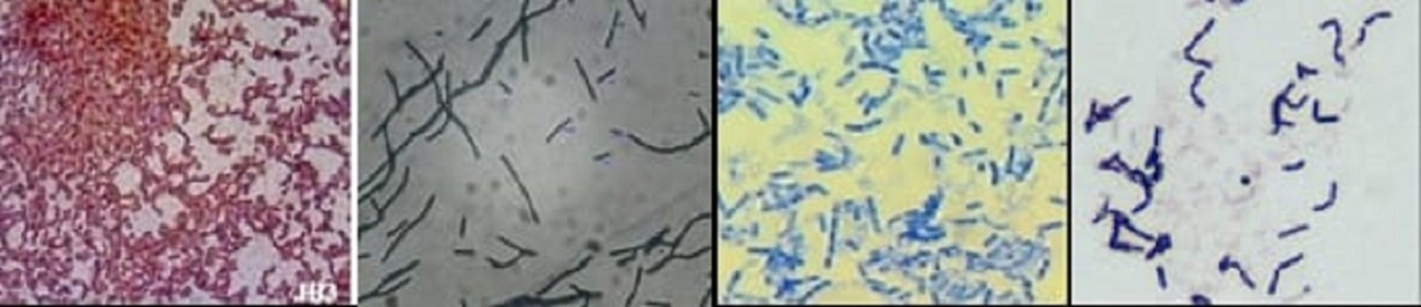 Bakteri yang berhasil diisolasi dan telah diuji secara biokimia, metabolisme, fisiologi dan potensinya