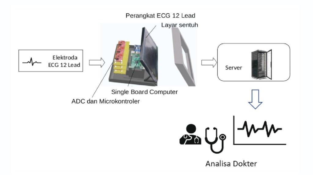 Metodologi sistem ECG 12 Lead secara keseluruhan