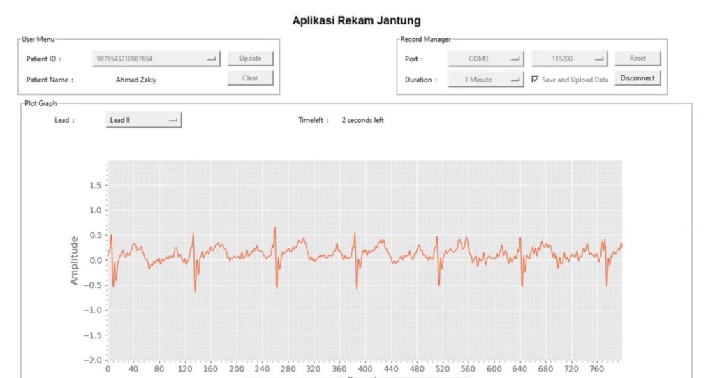 Tampilan grafik sinyal perekaman jantung secara real time pada website terintegrasi milik ECG 12 Lead