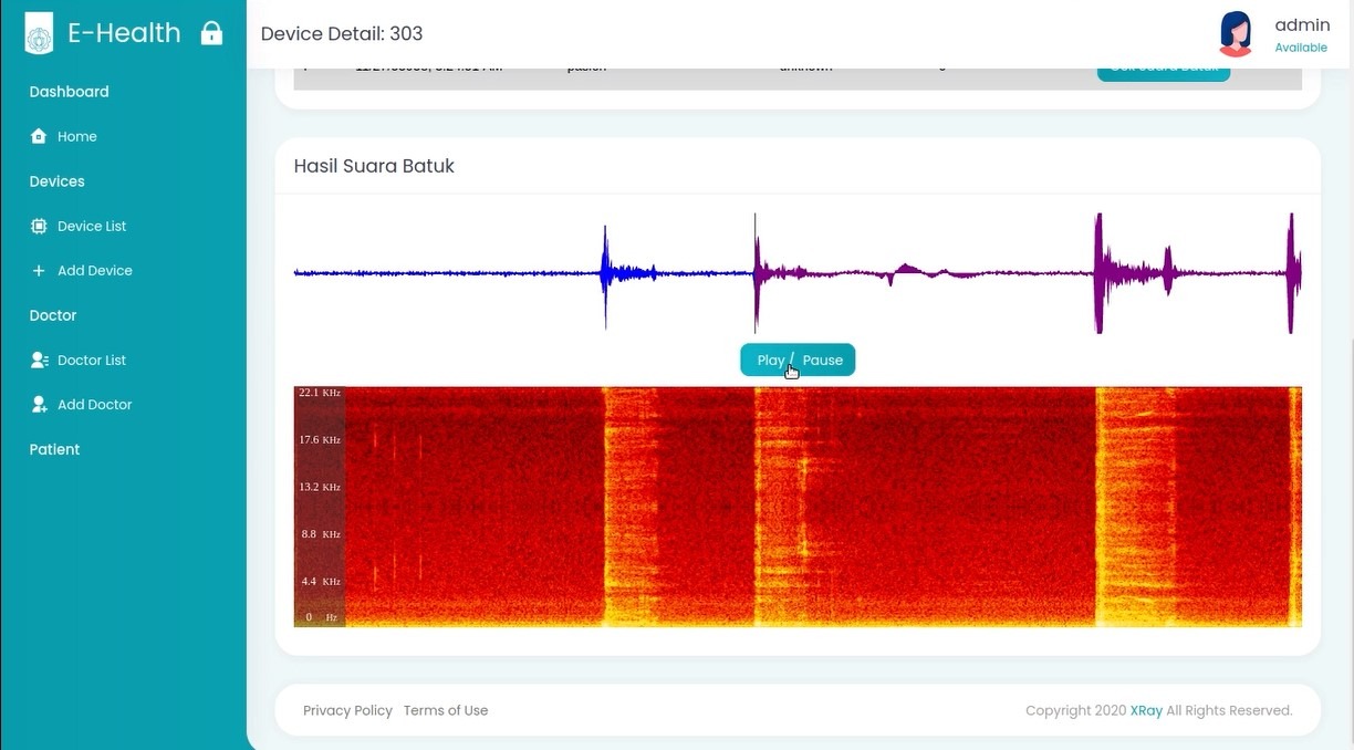 Hasil suara batuk yang terekam di website terintegrasi dengan elBicare Cough Analyzer