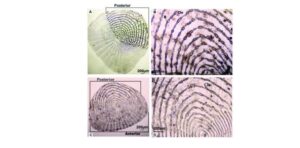 Hasil pengamatan mikroskopis kepadatan kromatofor pada sisik ikan yang mengalami ketidakteraturan bentuk setelah terpapar pencemaran polutan yang ada di perairan