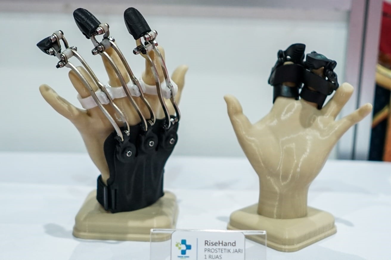 Gambar RiseHand, alat bantu untuk menggantikan fungsi jari pada pasien amputasi jari yang diciptakan oleh ITS