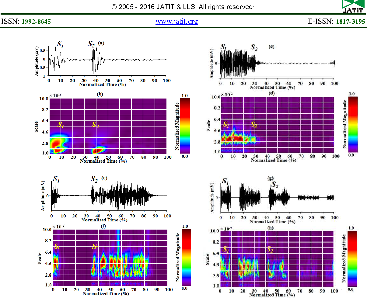 Analysis And Methods To Test Classification Of Normal And Pathological Heart Sound Signals